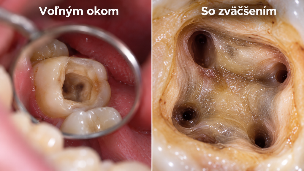 pracujeme pod zväčšením